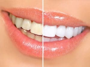 Elizabeth Cosmetic Dentistry