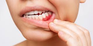 Elizabeth, CO Gum Disease Treatment